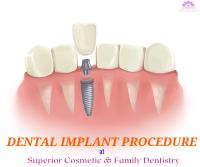 Superior Cosmetic & Family Dentistry image 39